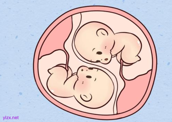 双胞胎在子宫内斗争出生后一红一白,原因究竟是何? 双胞胎在子宫内斗争出生后一红一白,原因究竟是何?