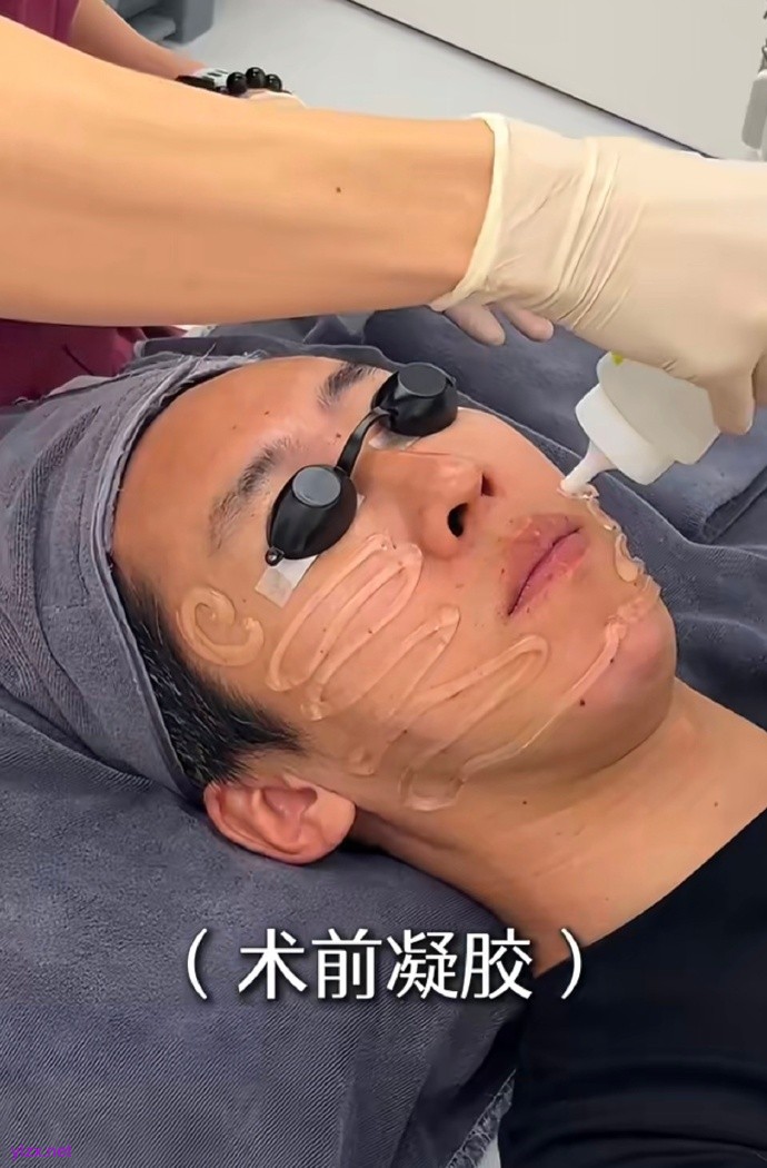 留几手做医美怎么回事 留几手为什么要做医美（图）