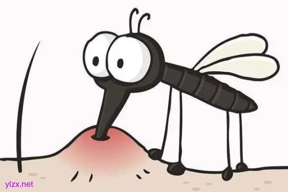 夏日蚊子叮咬起包可以挤吗？教你4招可以快速止痒消肿