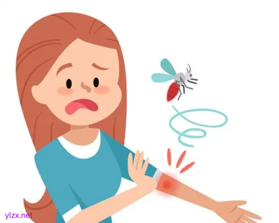 夏日蚊子叮咬起包可以挤吗？教你4招可以快速止痒消肿