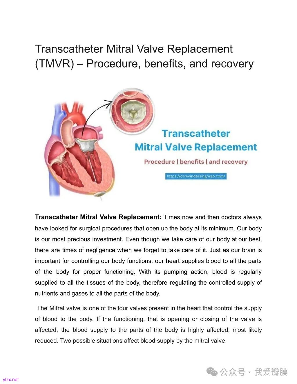 PPT - Transcatheter Mitral Valve Replacement (TMVR) PowerPoint ...